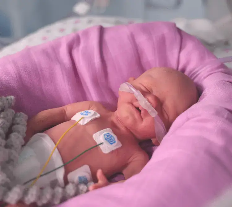 A neonate receiving HFOT via a nasal cannula